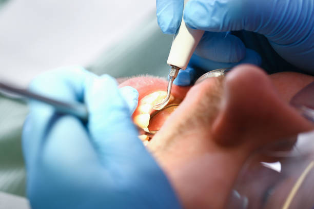 Best Dental Abscess Treatment in Grottoes, VA